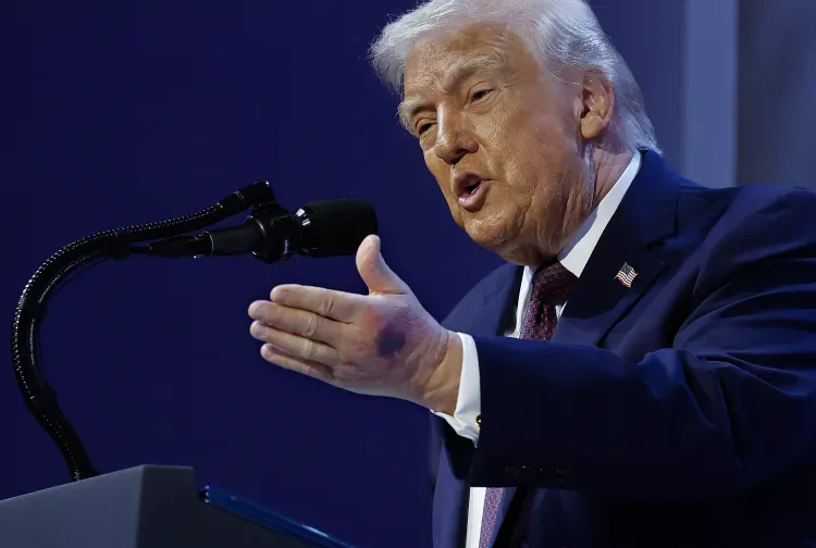 Trump's Health Arouses Heated Debate, His Hands Are Bruised And His Ankles Are Swollen, And Public Doubts Are Hard To Dispel-Lijin Finance